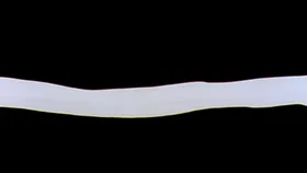 Splitting of the Breast — capture 14